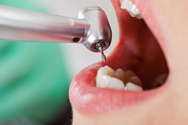 Best Emergency Dental Care for Broken or Chipped Teeth in Talent, OR